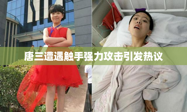 唐三遭遇触手强力攻击引发热议