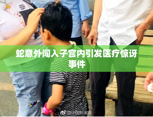 蛇意外闯入子宫内引发医疗惊讶事件