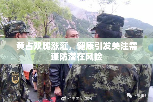 黄占双腿涨灌，健康引发关注需谨防潜在风险