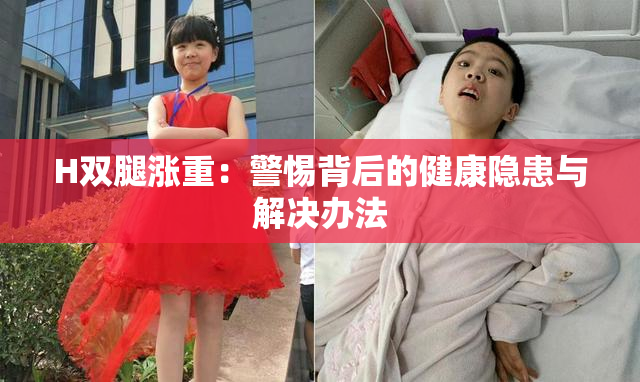 H双腿涨重：警惕背后的健康隐患与解决办法