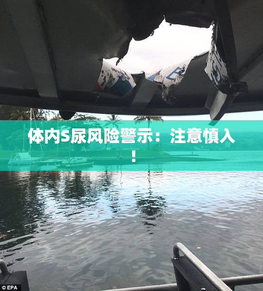 体内S尿风险警示：注意慎入！