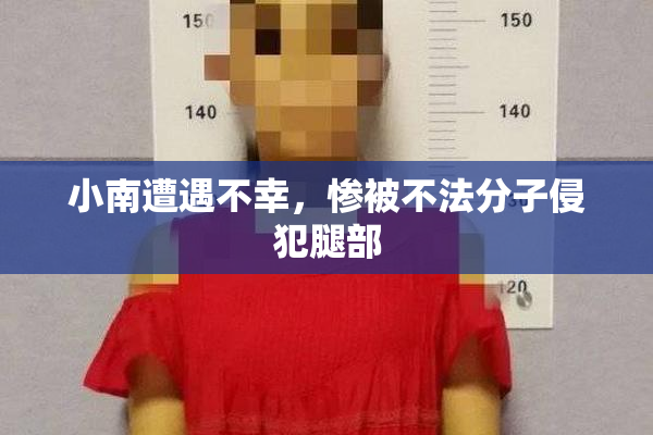 小南遭遇不幸，惨被不法分子侵犯腿部