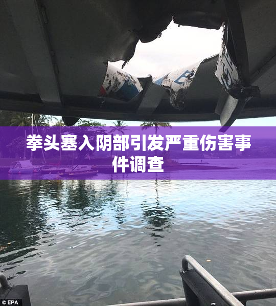 拳头塞入阴部引发严重伤害事件调查