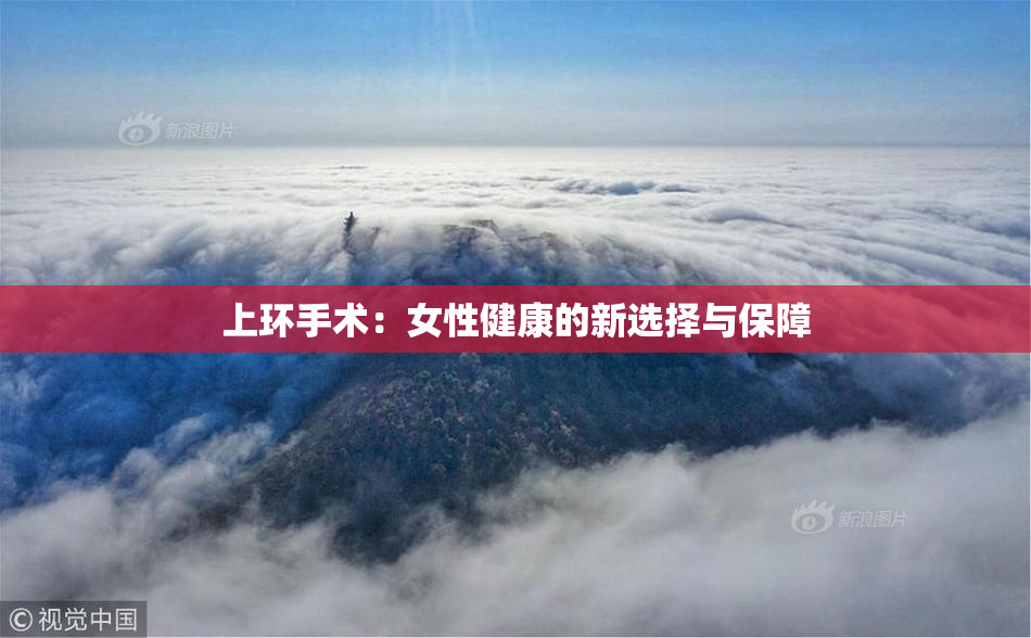 上环手术：女性健康的新选择与保障