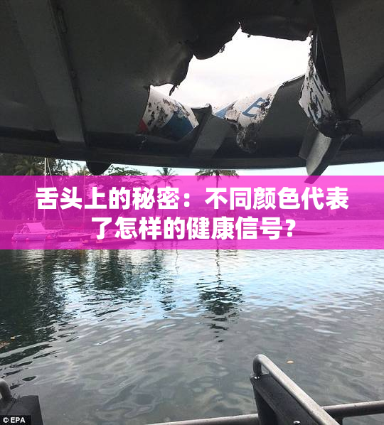 舌头上的秘密：不同颜色代表了怎样的健康信号？