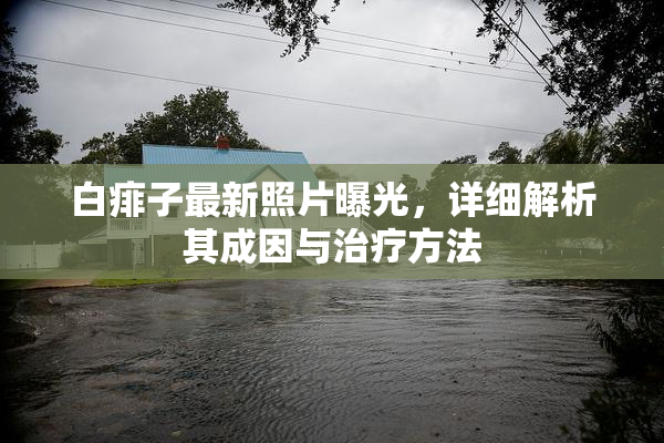 白痱子最新照片曝光，详细解析其成因与治疗方法