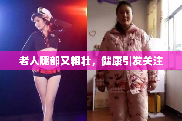 老人腿部又粗壮，健康引发关注